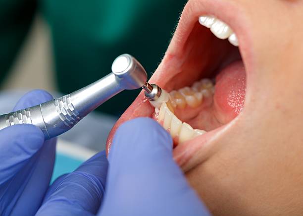 Best Tooth Extraction  in Danvers, IL